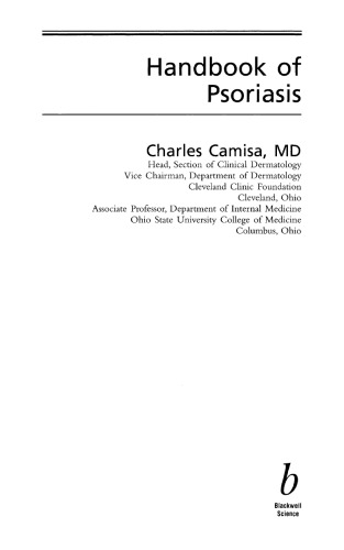 Handbook of Psoriasis