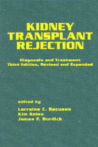 Kidney Transplant Rejection: Diagnosis & Treatment