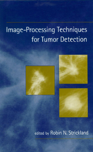 Image-Processing Techniques for Tumor Detection