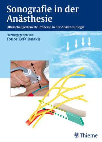 Sonographie in der Anästhesie. Ultraschallgesteuerte Prozesse in der Anästhesiologie