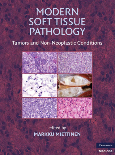 Modern Soft Tissue Pathology: Tumors and Non-Neoplastic Conditions