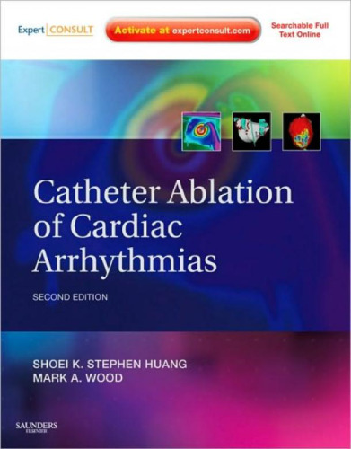 Catheter Ablation of Cardiac Arrhythmias: Expert Consult - Online and Print, 2nd Edition