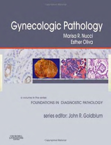 Gynecologic Pathology (Foundations in Diagnostic Pathology Series)