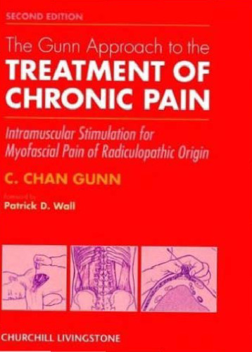 Gunn Approach to the Treatment of Chronic Pain: Intramuscular Stimulation for Myofascial Pain of Radiculopathic Origin