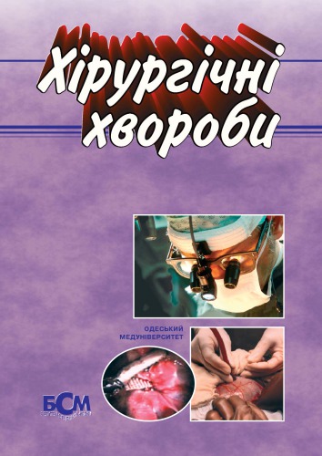 Хірургічні хвороби. Підручник.