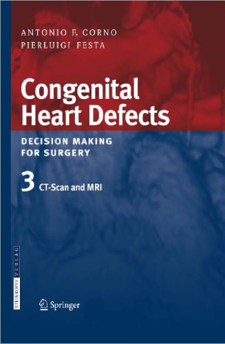 Congenital Heart Defects