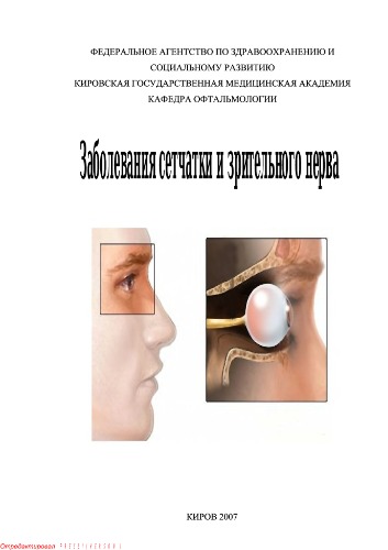 Заболевания сетчатки и зрительного нерва