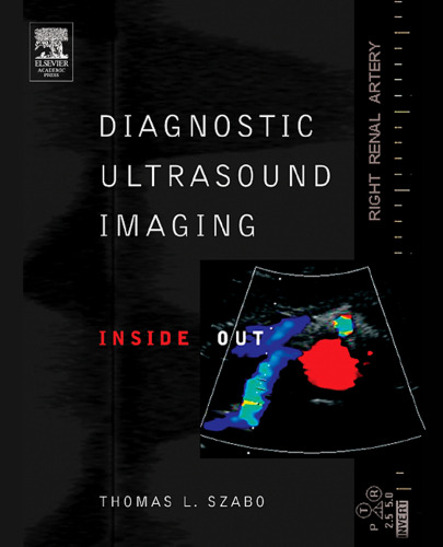 Diagnostic Ultrasound Imaging: Inside Out (Biomedical Engineering)  