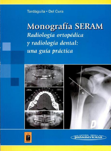 Monografia SERAM: Radiologia Ortopedica Y Radiologia Dental. Una guía práctica  