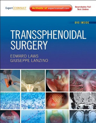 Transsphenoidal Surgery: Expert Consult - Online and Print  