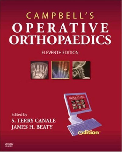 Campbell's Operative Orthopaedics: 4-Volume Set, 11th Edition