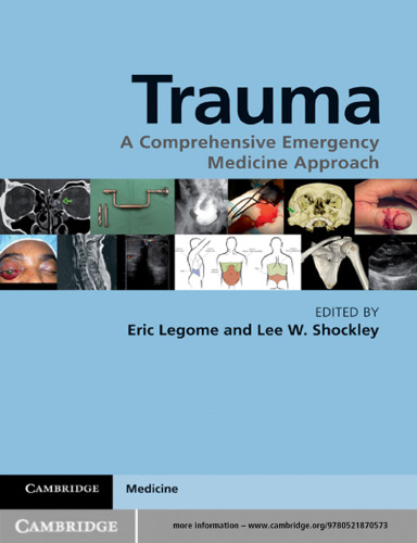 Trauma: A Comprehensive Emergency Medicine Approach  
