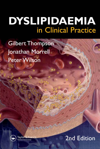 Dyslipidaemia in Clinical Practice, 2nd Edition  