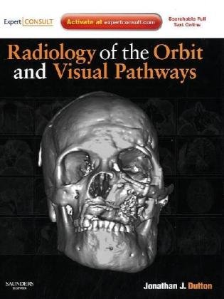 Radiology of the Orbit and Visual Pathways: Expert Consult: Online and Print (Expert Consult Title: Online + Print)