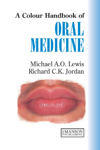 A Colour Handbook of Oral Medicine  