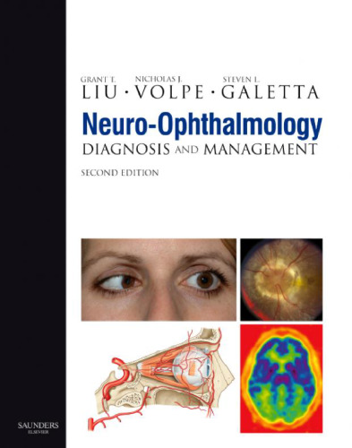 Neuro-Ophthalmology: Diagnosis and Management, Second Edition  