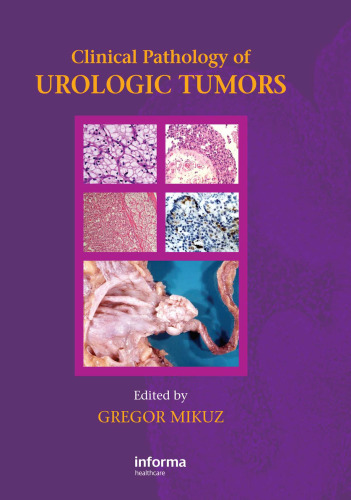 Clinical Pathology of Urological Tumors  