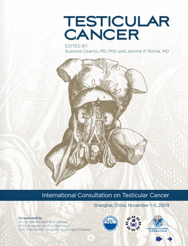 Testicular Cancer  