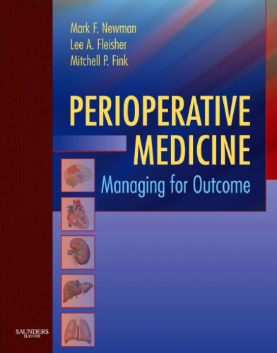 Perioperative Medicine: Managing for Outcome