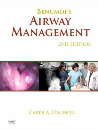 Benumof's Airway Management, Second edition