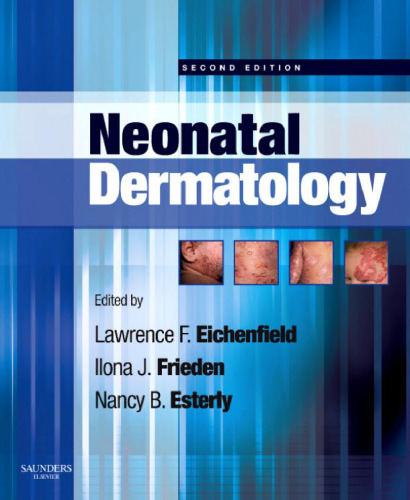 Neonatal Dermatology, Second Edition  