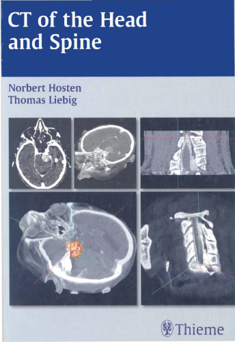 CT of the Head and Spine  