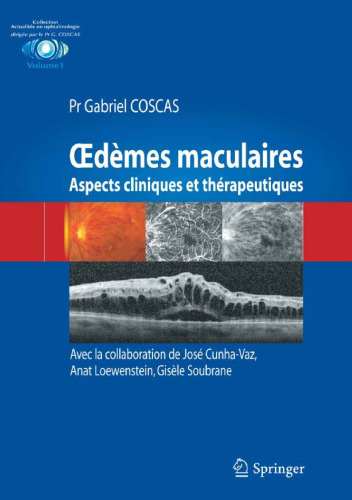 Œdèmes maculaires : Aspects cliniques et thérapeutiques  