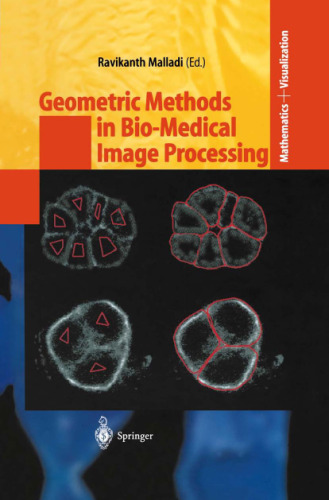 Geometric Methods in Bio-Medical Image Processing  