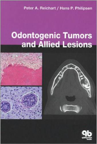 Odontogenic tumors and allied lesions