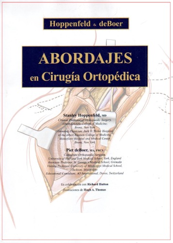 Abordajes en Cirugía Ortopédica