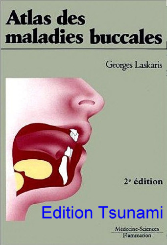 Atlas des maladies buccales  