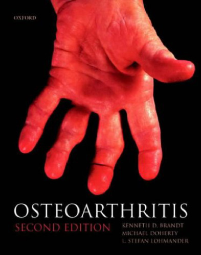 Osteoarthritis