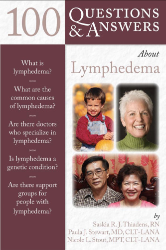 100 Questions & Answers About Lymphedema  