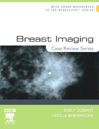 Breast Imaging: Case Review Series