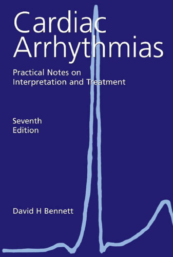 Cardiac Arrhythmias: Practical Notes on Interpretation and Treatment