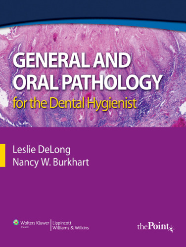 General and oral pathology for the dental hygienist