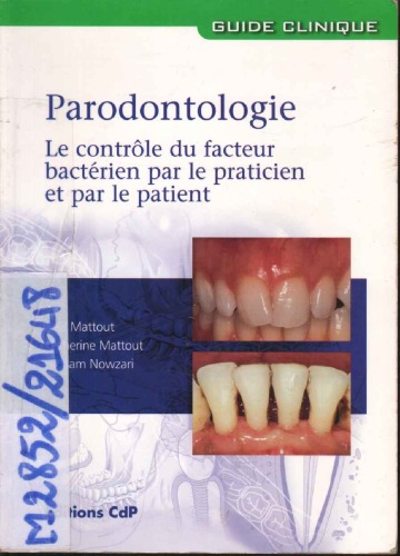 Parodontologie : le contrôle du facteur bactérien par le praticien et par le patient