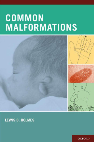 Common Malformations  