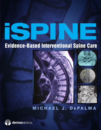 iSpine: Evidence-Based Interventional Spine Care