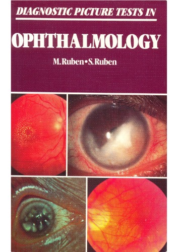 Diagnostic Picture Tests in Ophthalmology
