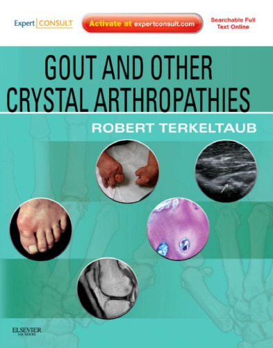 Gout and Other Crystal Arthropathies