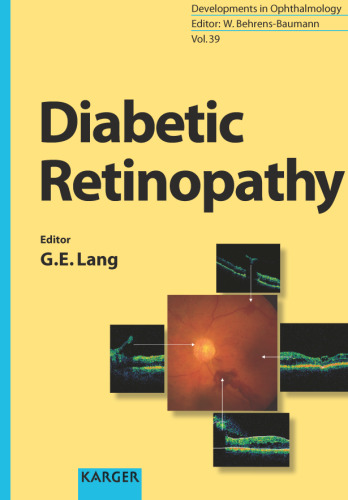 Diabetic Retinopathy  