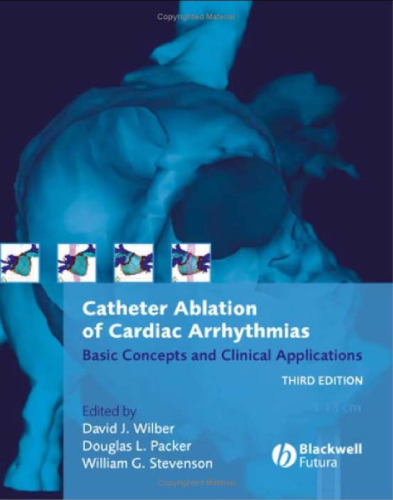 Catheter Ablation of Cardiac Arrhythmias: Basic Concepts and Clinical Applications, Third Edition  