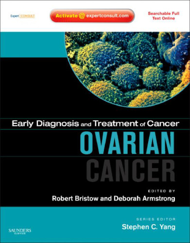 Early Diagnosis and Treatment of Cancer Series: Ovarian Cancer: Expert Consult