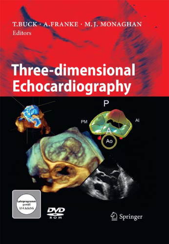 Three-dimensional Echocardiography  