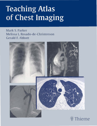 Teaching Atlas of Chest Imaging  