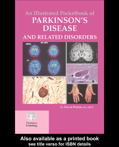 An Illustrated Pocketbook of Parkinson’s Disease and Related Disorders