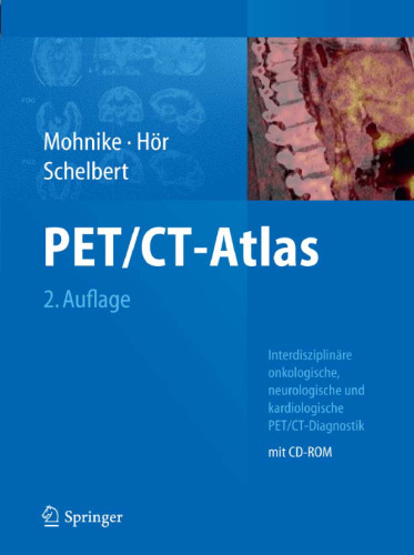 PET CT-Atlas, 2. Auflage: Interdisziplinäre onkologische, neurologische und kardiologische PET CT-Diagnostik
