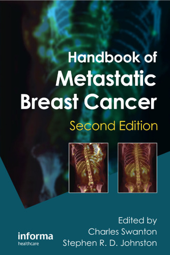 Handbook of Metastatic Breast Cancer: Second Edition