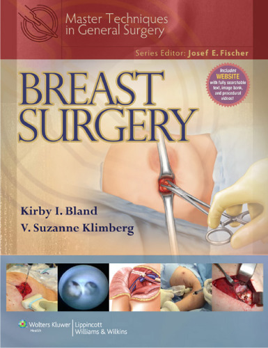 Master Techniques in General Surgery: Breast Surgery  